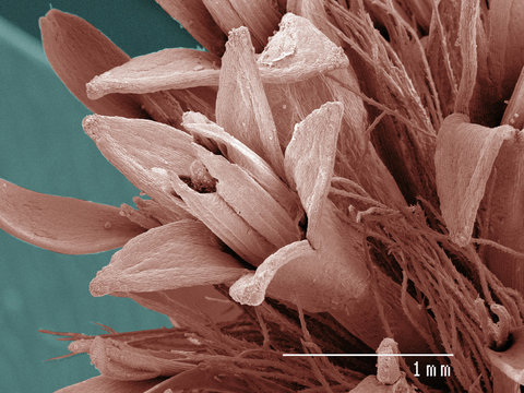 Coloured SEM of goldenrod flower