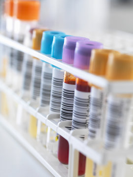 A row of human samples for analytical testing including blood, urine, chemistry, proteins, anticoagulants and HIV