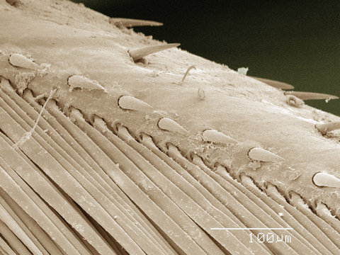 Coloured SEM of backswimmer (Notonectidae) leg