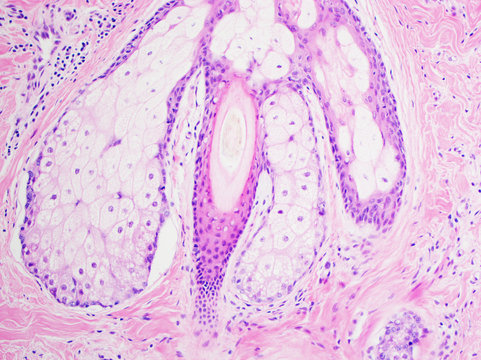 H&E stain, light microscopy, normal hair follicle