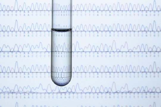 Test tube containing liquid with computer monitor displaying results of automated DNA sequencing