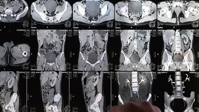 doctors regard chest x-ray