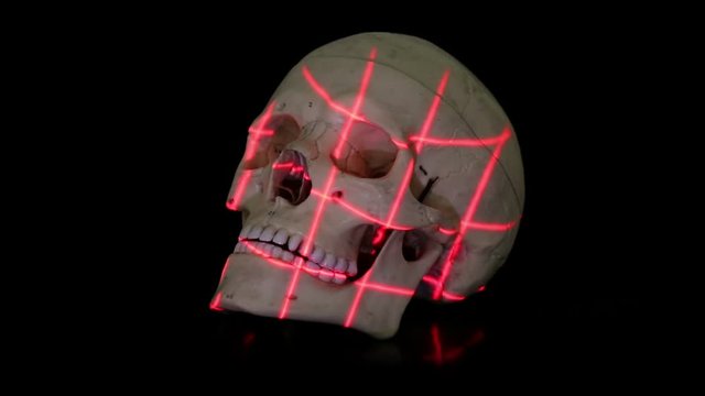 Three dimensional scan of human skull model with rotational grid