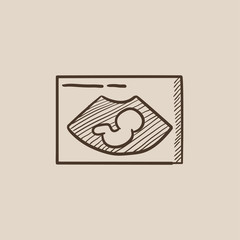 Fetal ultrasound sketch icon.