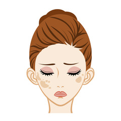 Spotted - Facial Skin Trouble シミ　スキンケアトラブル　女性　顔アップ