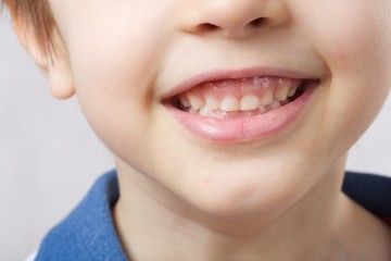 Fototapeta premium Teeth of a 6 years old child