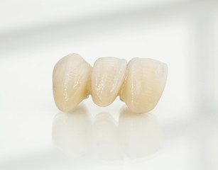 Fototapeta na wymiar Metal free ceramic dental crowns