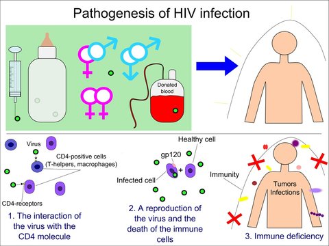 Pathogenesis of HIV infection