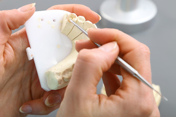 Technik dentystyczny pracuje nad modelem szczęki  - obrazy, fototapety, plakaty