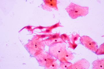 Human cells view in microscopy.Squamous metaplastic cells from pap smear.Medical background