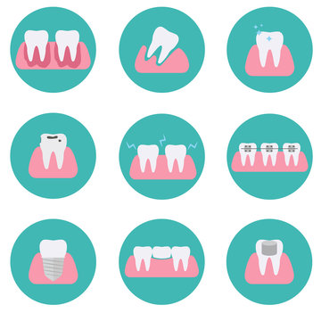 Set of modern flat vector conceptual icons of teeth conditions, stomatology, dentistry, orthodontics, oral health care and hygiene, tooth restoration