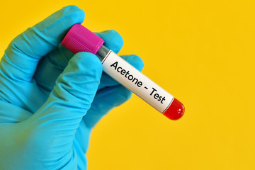 Obraz premium Test tube with blood sample for acetone test 
