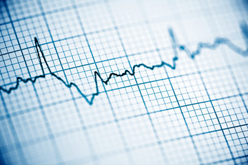 Electrocardiogram