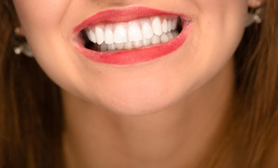 Closeup young womans mouth showing white healthy teeth