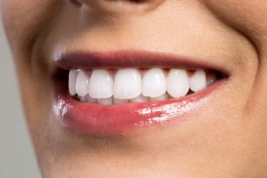 Detail of young womans smile showing white teeth