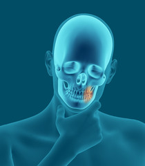X-ray scan of a man with a toothache