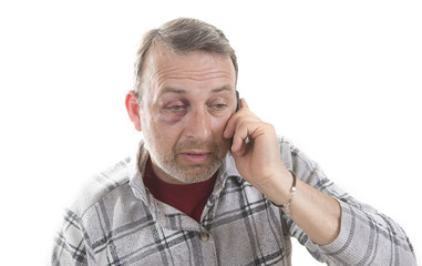 Obraz premium Middle-aged Caucasian male Emotional Portrait with a Real Bruise