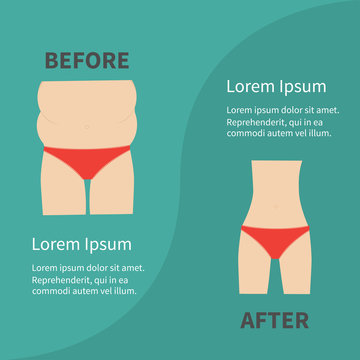 Before after infographic Woman fat and skinny figure red underwear. Healthy unhealthy lifestyle Flat design