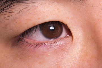 Fototapeta premium Eye of a Asian man 