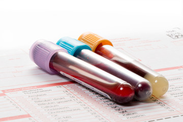 Blutuntersuchung, Blutproben auf einem Laborformular