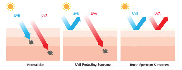 Sunscreen protecting compare between normal skin and skin with s