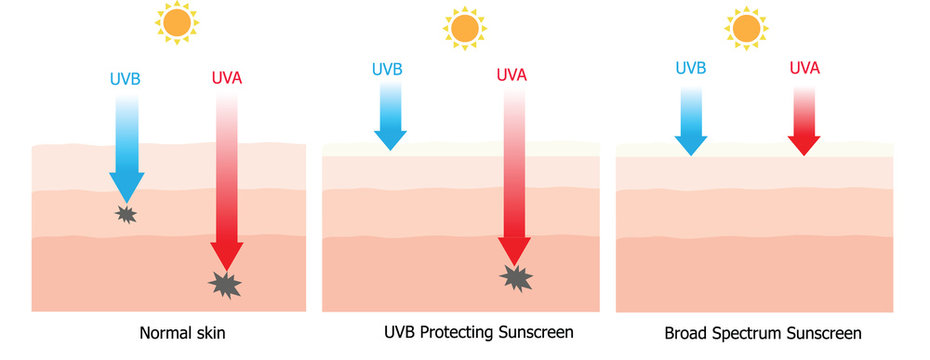 Sunscreen protecting compare between normal skin and skin with s