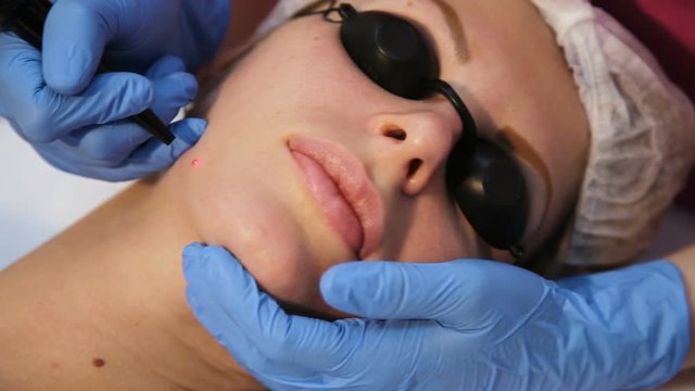 Woman getting laser face treatment in medical spa center, skin rejuvenation concept.Cosmetic surgeon doctor giving fractional CO2 laser skin treatment to the face of a senior female woman patient