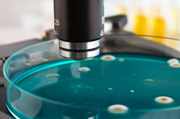 detail of petri dish in the laboratory microscope / petri plate in micro on workbench of...