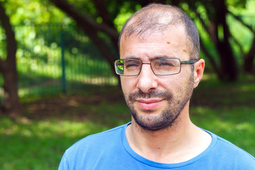 portrait of young man with bad eyesight and hair loss.