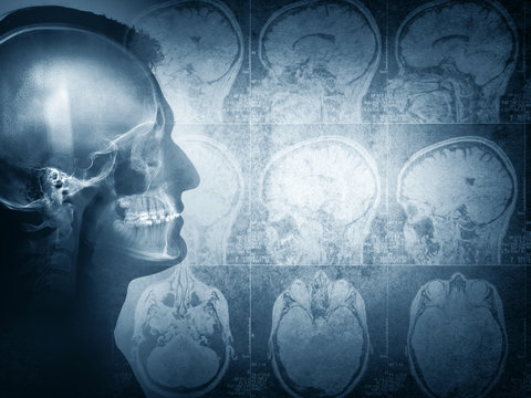 Conceptual image of a man from side profile showing brain and brain activity. Retro stale.