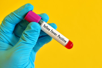 Obraz premium Blood sample positive with yellow fever test 