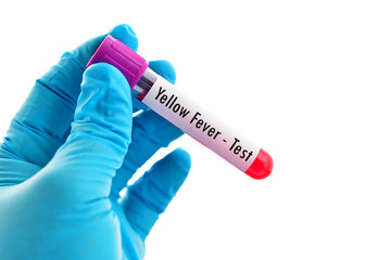 Obraz premium Test tube with blood sample for yellow fever test 