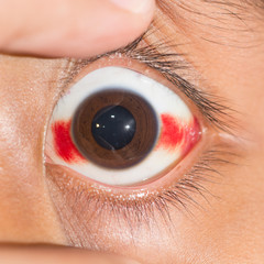 eye test