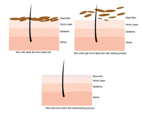 Skin replinished the new one after the peel the dead skin
