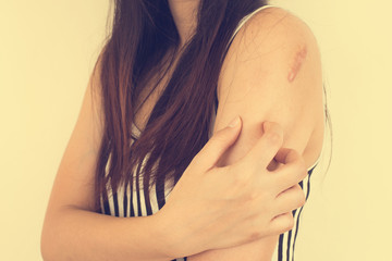 Itching In A Woman. Vintage closeup portrait.