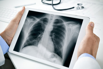 doctor observing a chest radiograph in a tablet