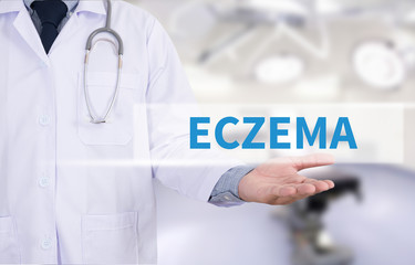 ECZEMA