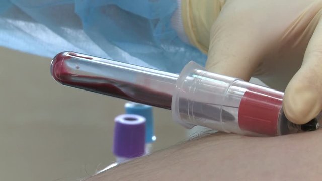 The blood analysis. Analysis to identify the HIV virus.