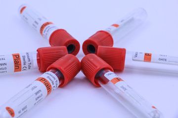 Blood tube for testing in laboratory