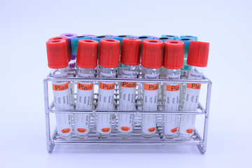 Blood tube for testing in laboratory