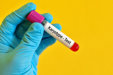 Obraz premium Blood sample for karyotype (abnormal chromosome study) testing 
