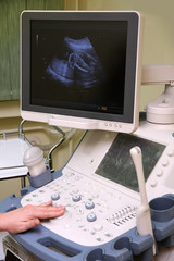 medical examining pregnant belly by ultrasonic scan of a baby on