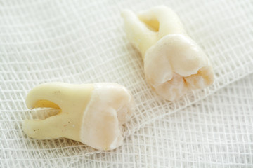 Removed wisdom tooth on white