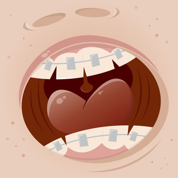 braces mouth cartoon funny clipart