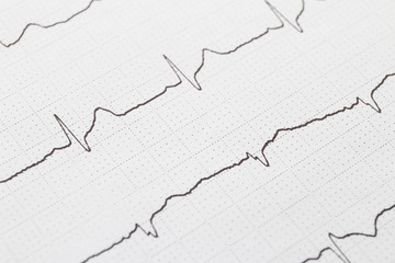 Close up of electrocardiogram chart background