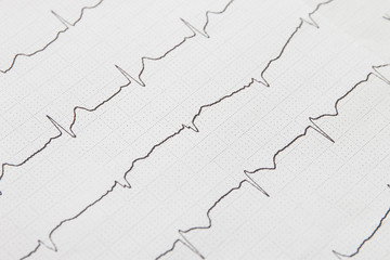 Close up of electrocardiogram chart background
