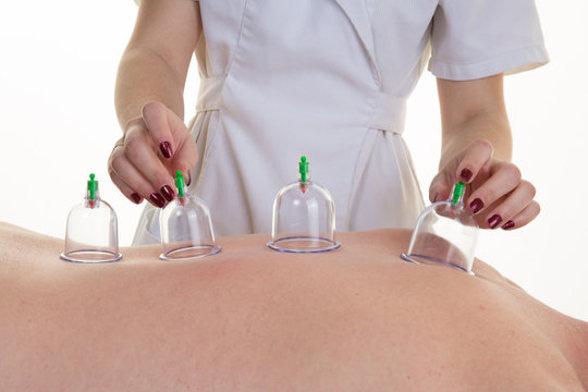 Woman therapist Placing Cup On The Back Of A Female Patient