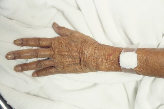 old woman's hand is on a drip receiving a saline solution.