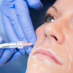 Naklejka premium Hyaluronic acid injection