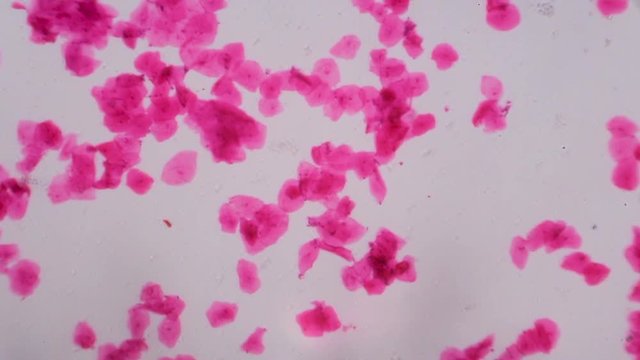 Multiple squamous epithelium under the microscope - Abstract pink dots on white background.